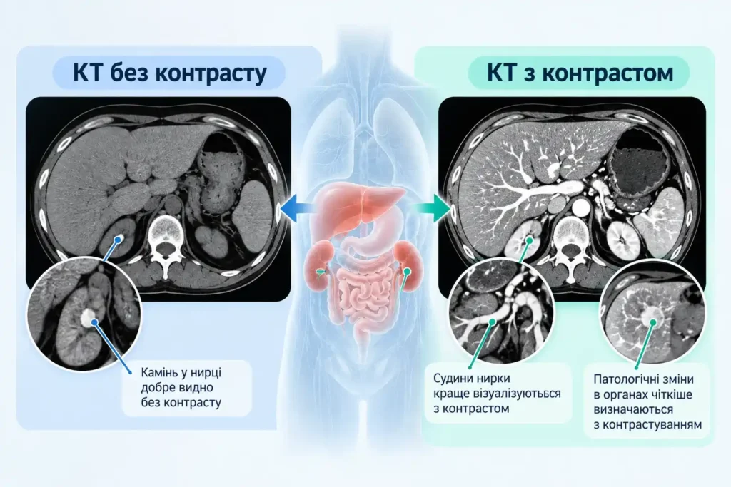 різниця між кт з контрастом і без